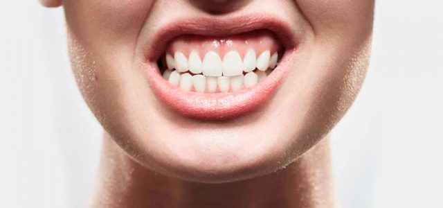 Qué es el bruxismo y qué solución tiene - Clínica Dental Barrigón