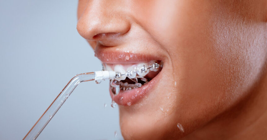 ¿Cuándo  y cómo usar el irrigador dental?