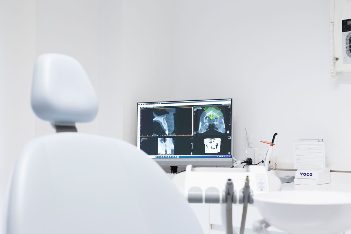 Estudio 3D (CBCT) de un maxilar en el monitor de un gabinete de Clínica Dental Barrigón, Valladolid