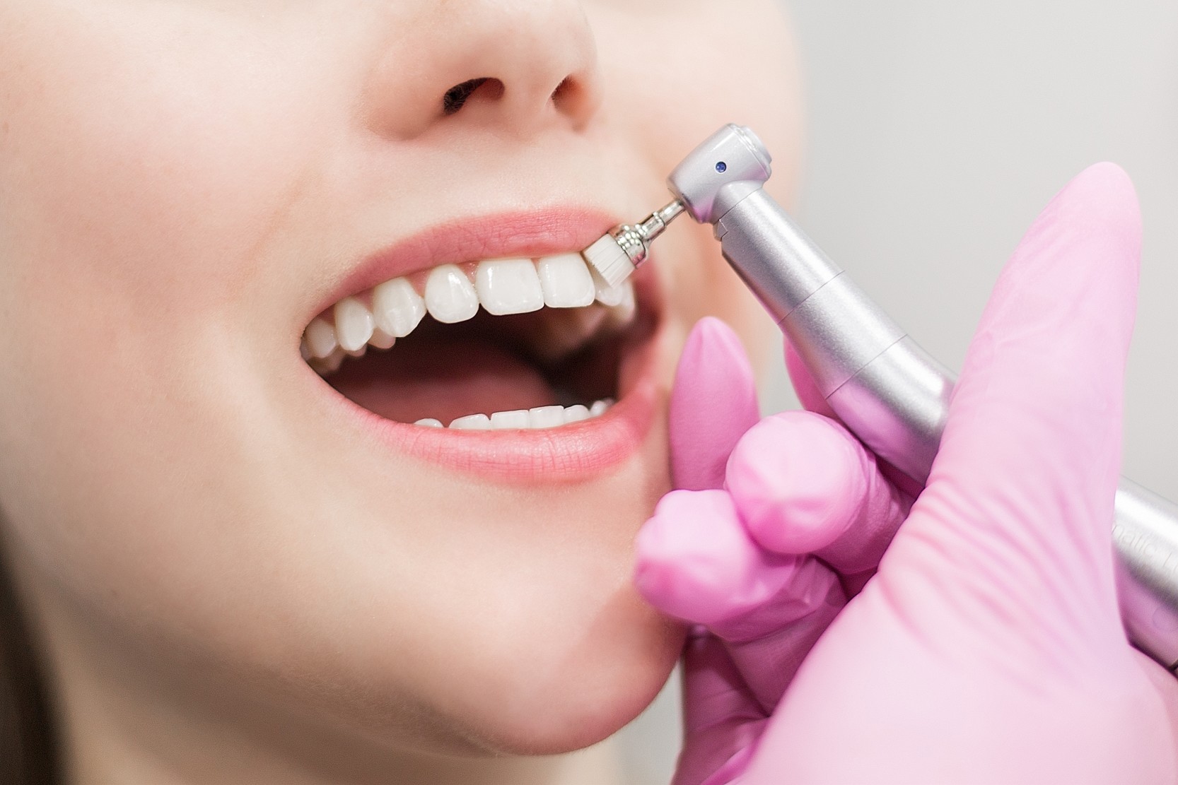 La periodontitis: síntomas, causas y tratamiento