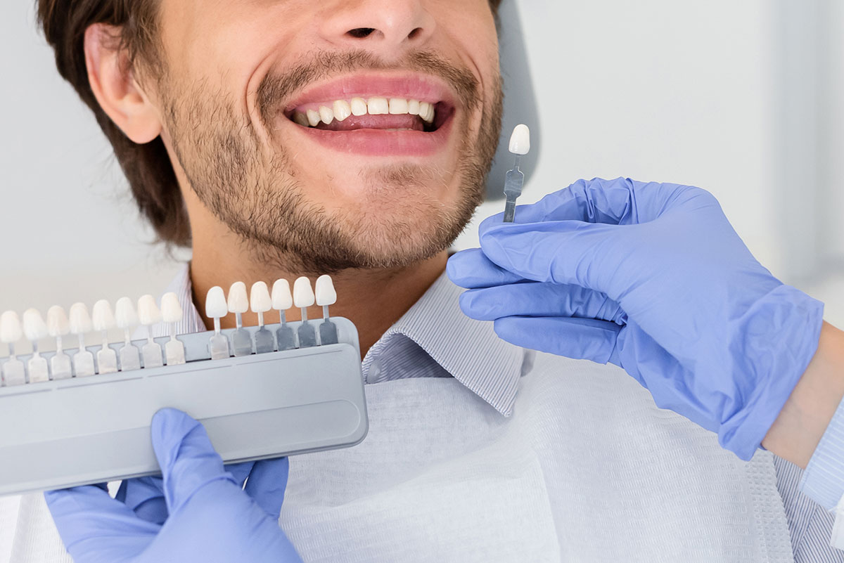 5 mitos falsos sobre el blanqueamiento dental