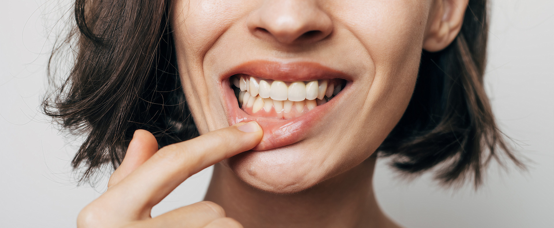 Retracción de encías: causas, síntomas y tratamientos en Valladolid