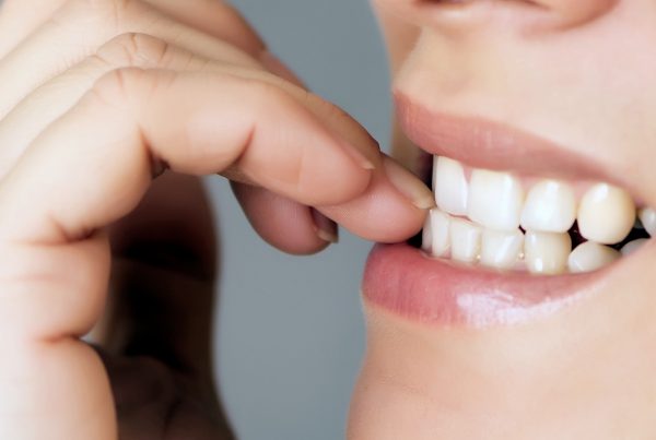 Dientes-translucidos