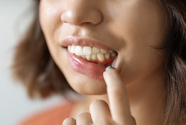 encia-inflamada-alrededor-de-un-diente