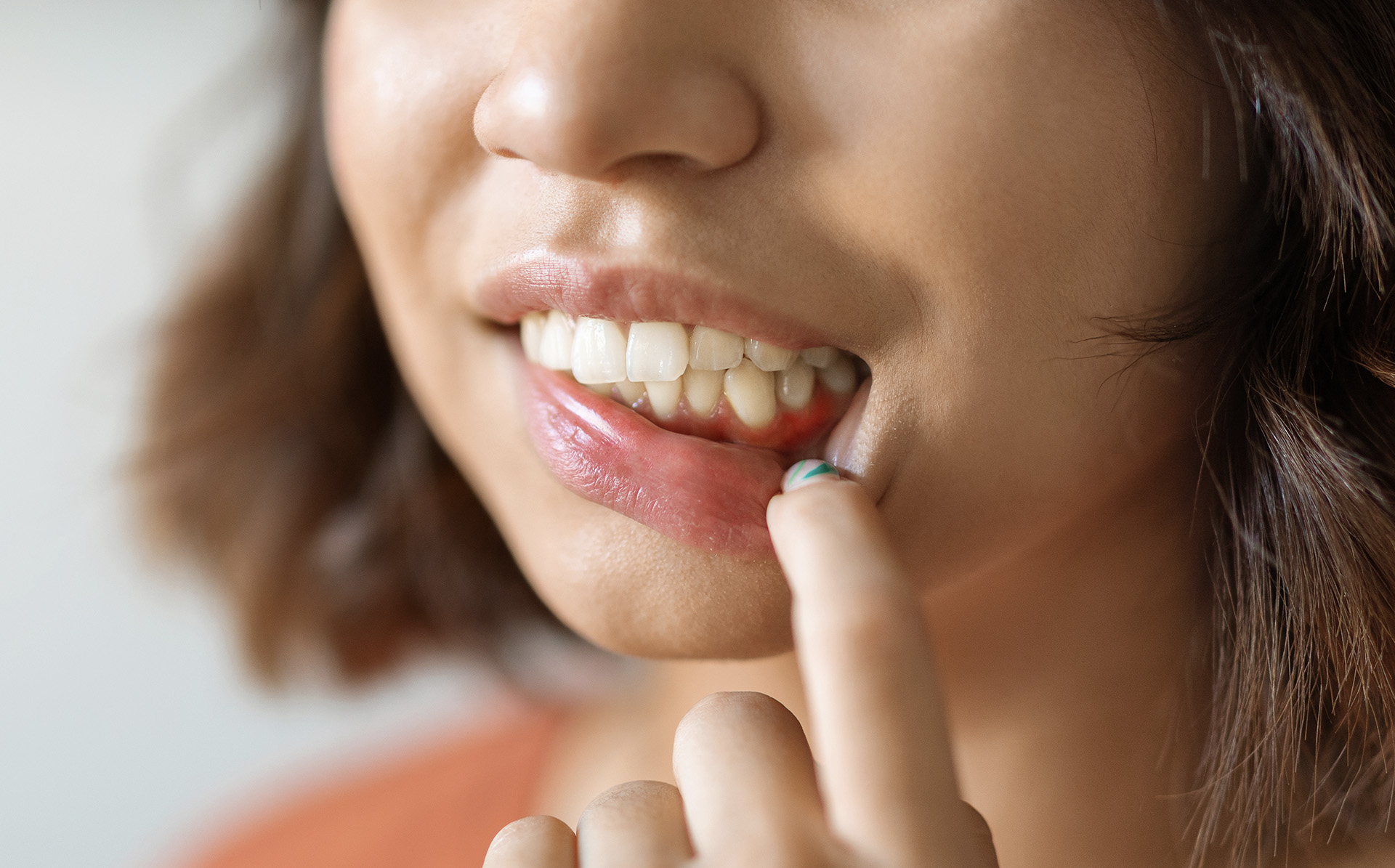 Encía inflamada alrededor de un diente: causas y qué hacer en Valladolid