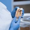 endodoncia-valladolid-tratamiento-conducto