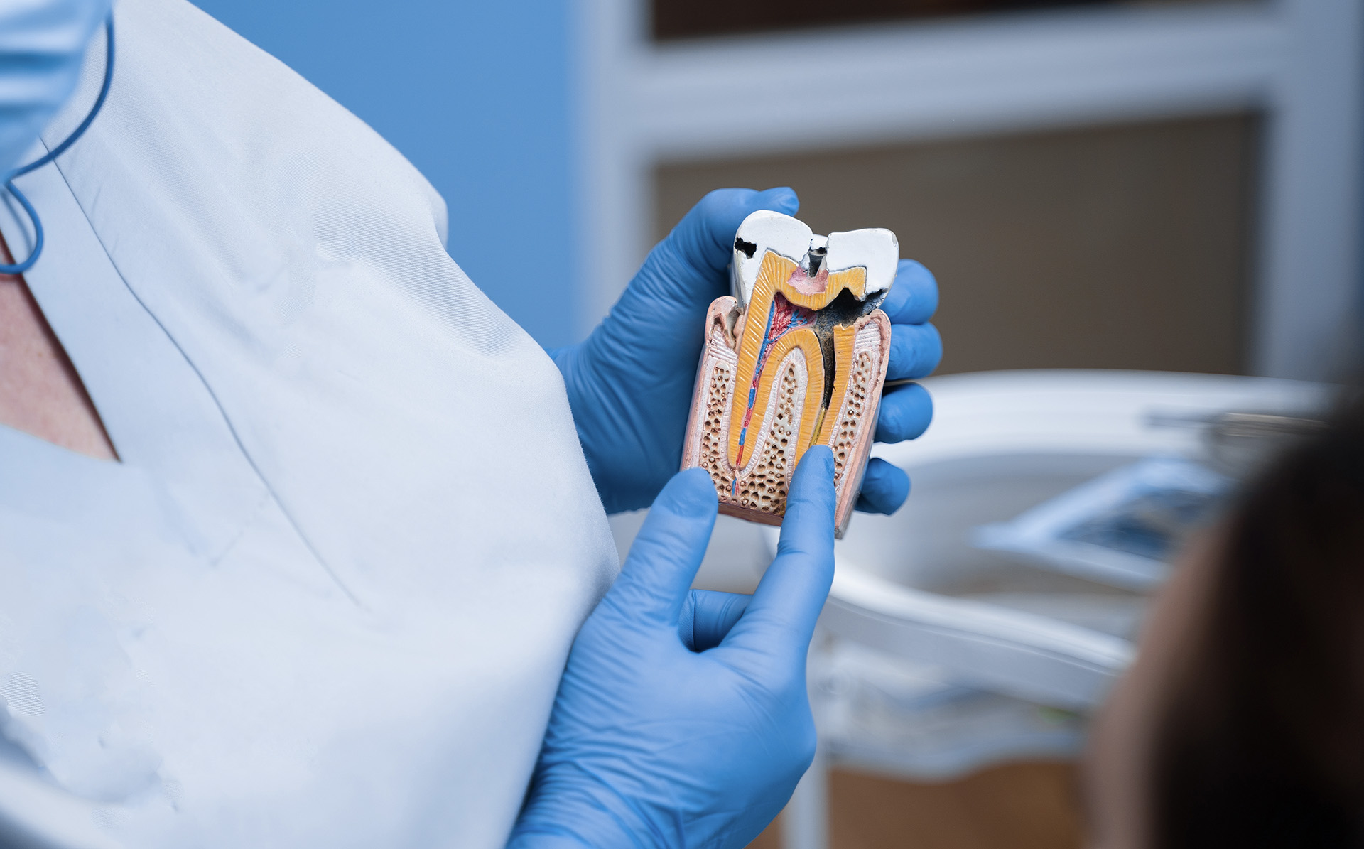 endodoncia-valladolid-tratamiento-conducto