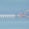 Extracción dental en Valladolid: tratamiento en Clínica Dental Barrigón